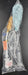 Endo Rectal MRI Probe For 1.5T MR Imaging of the Prostate - m.e.d. GmbH Schulz